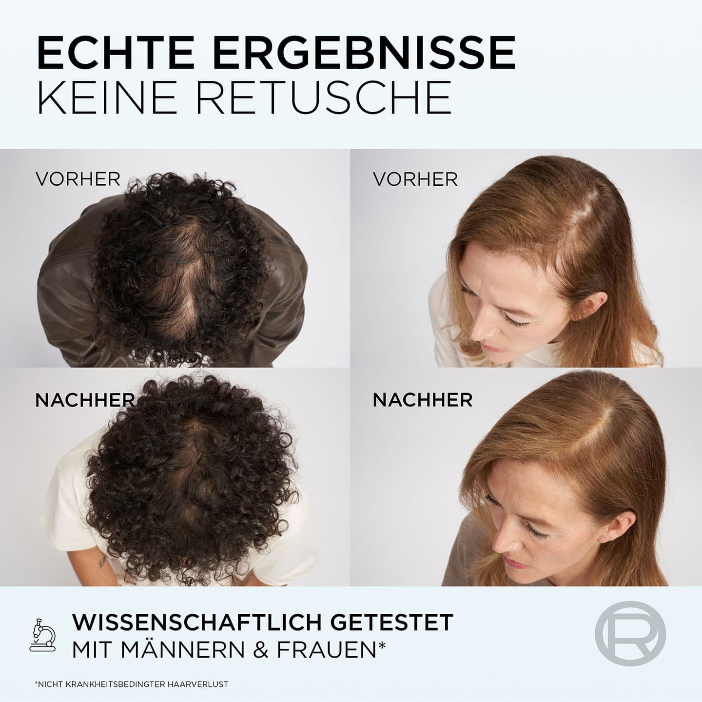 Vorher Nachher Ergebnisse zur Anwendung der Elvital Fiber Booster Spülung